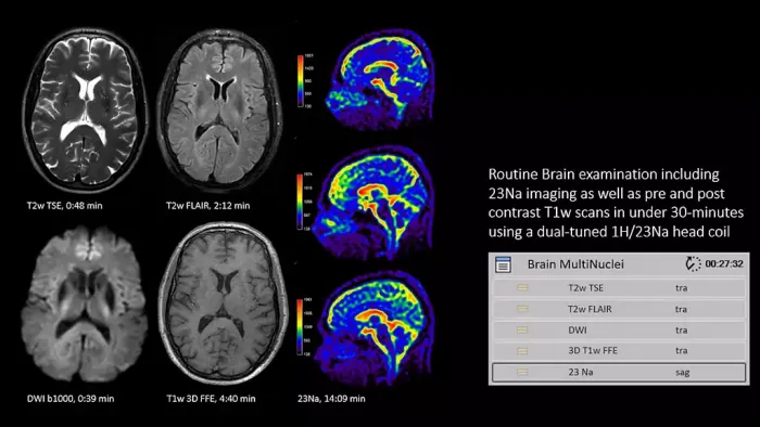 Ingenia Elition 3.0T S