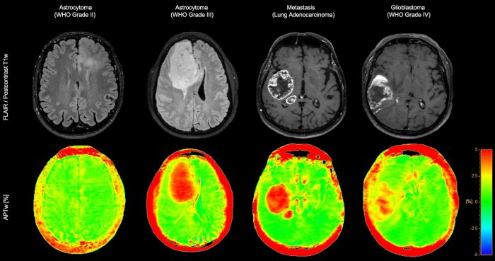 Ingenia Elition 3.0T X