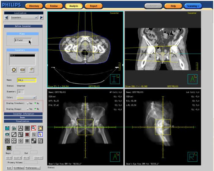 Philips Spectral CT 7500 RT