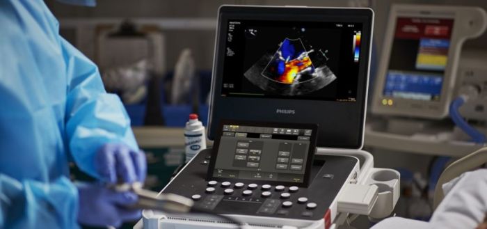 Philips Compact Ultrasound System 5300 series